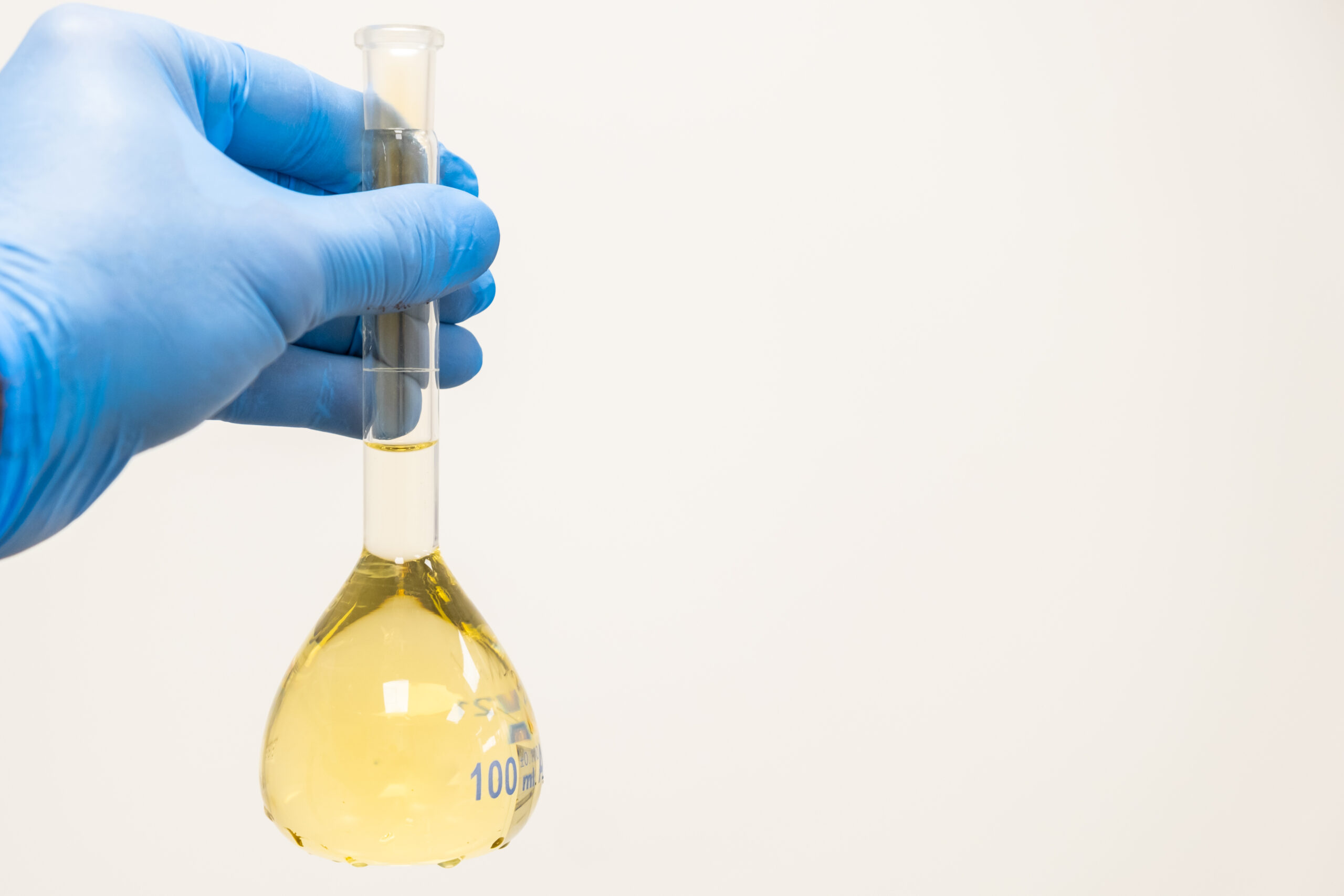scientist holding urine bottle
