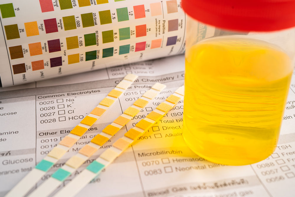 Innovating With Artificial Urine For Research And Lab Discoveries with calibrating strips