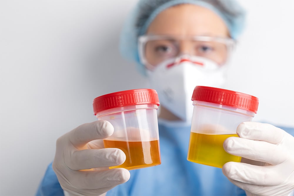 Synthetic Urine vs Natural Urine: Use Cases, Accuracy, and Best Practices