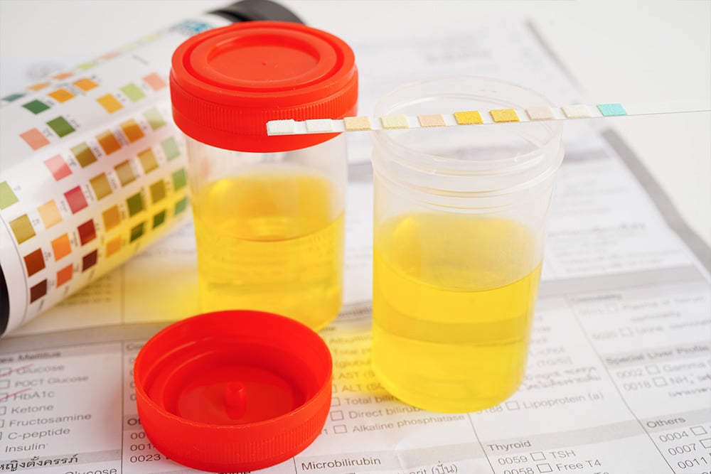 The Manufacturing Process of Synthetic Urine: Challenges, Innovation & Quality Assurance